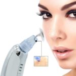 Επαναφορτιζόμενη Συσκευή Καθαρισμού Για Τα Μαύρα Στίγματα electronistas.gr